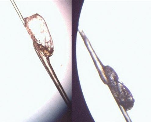 Viable lice egg on the left and a dead, dehydrated lice egg on the right