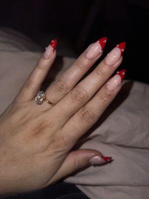 Horrible nails