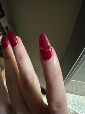 broken nail