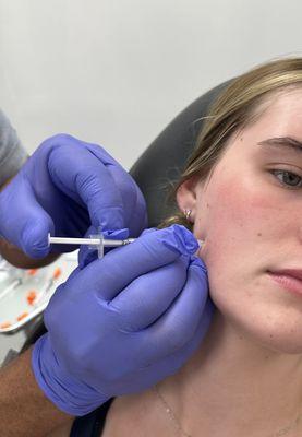 Botox to eliminate jaw pain