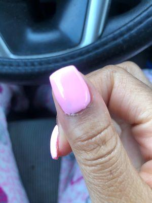 This is the nail that was bleeding, you can see how deep she went in my cuticle