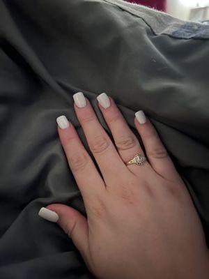 ring finger nail is crooked