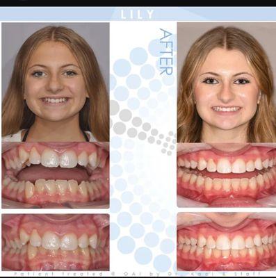 We change your smile  .. We do treatment for braces 
Get 10% with the treatment in our location