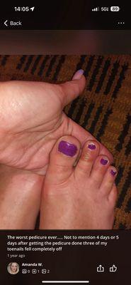 Ugly toes