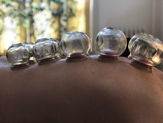 Cupping Therapy