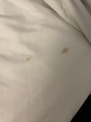 Blood stains on sheets?