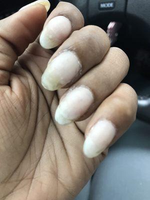 Does this look right to you? My nails are different shapes and the acrylic is uneven. And dirty!