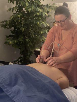 Angela Tyree performing MediCupping on a client at Merit Massage Care in Johnson City.