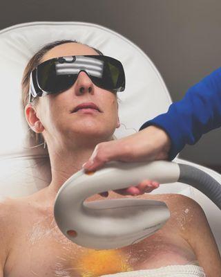 Laser Skin Services with Nurse Kathy