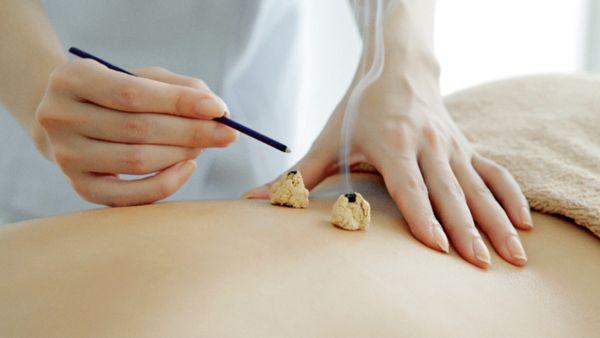 Moxibustion treatment