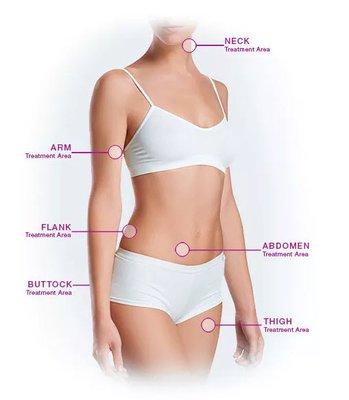 Common areas for liposuction