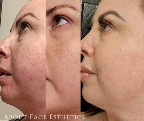 About Face Esthetics