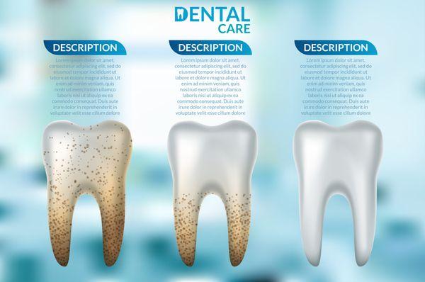 Dr Ishani Dhillon Shah, DDS evaluates each patient & recommends a plan for your long term dental care. Get back the Smile you deserve!