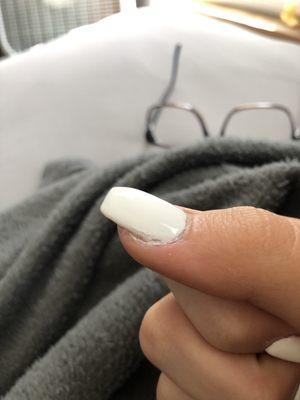 This is the nail they kept screwing up and they sent me home with this. They look awful.