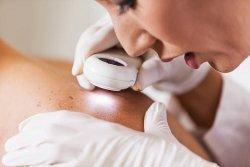 Desert Dermatology & Skin Cancer Specialists - DOC EXAMINING SKIN