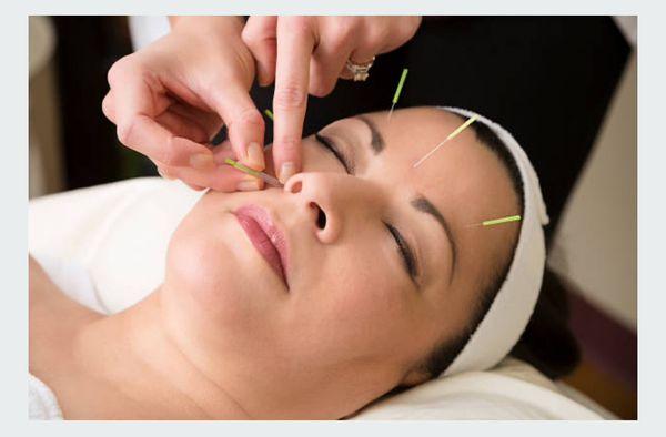 Facial acupuncture