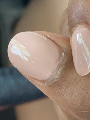 Uneven polish line and peeling skin