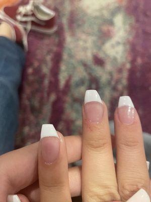 half of her nails are missing wtf