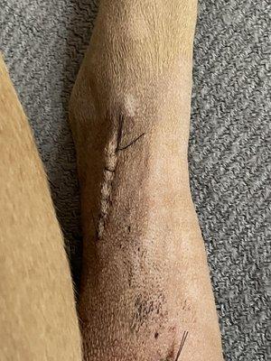 Repair on lower leg