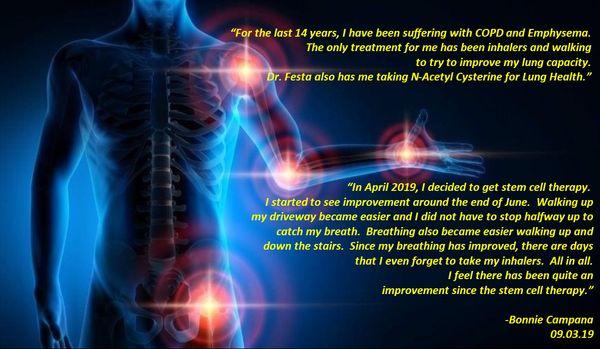 Stem Cell Therapy Testimonial