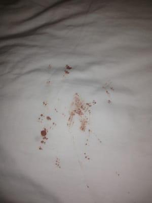 Blood stains on our sheets!!!