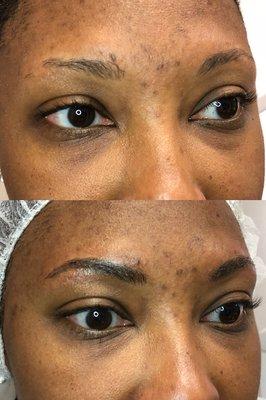 Microblading + shading