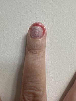 Avoid this happening to you 4 days after getting your nails done here! That's my exposed nail bed!