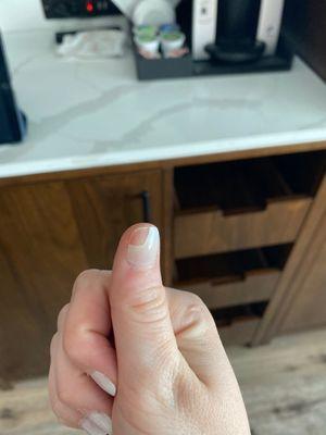 Mail that chipped 5 days after gel manicure