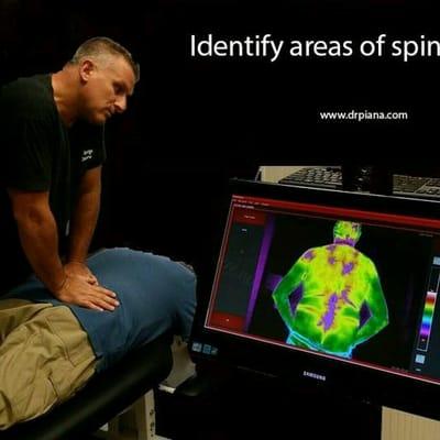 Dr Plana is a Torrington Chiropractor who uses thermography to find areas if spinal stress