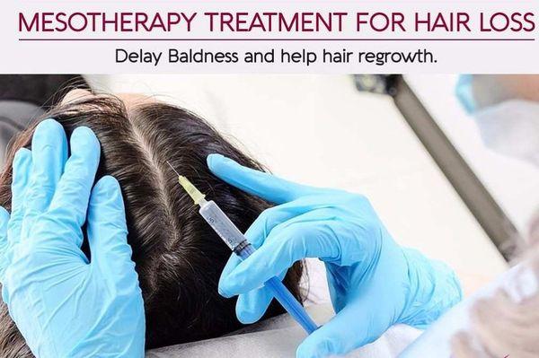 Mesotherapy for hair regrowth