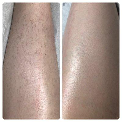 before and after leg wax