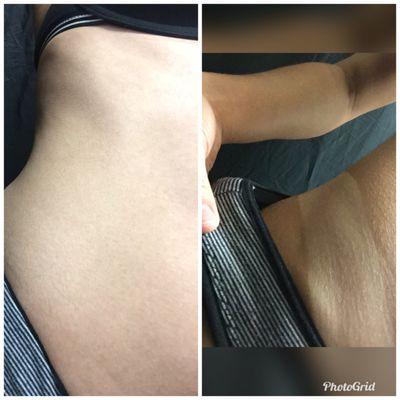 Before and after medium tan