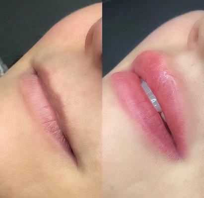 lip blush treatment