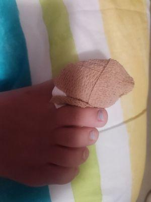 My baby's toe wrapped