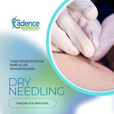 We Offer Dry Needling. 

Visit us and try this  service.