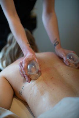 Cupping