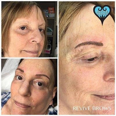 Revive Brows