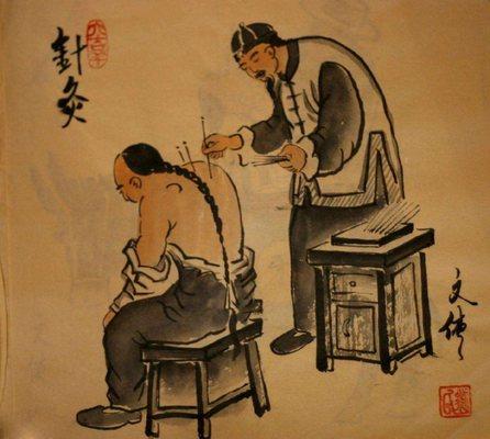 Alpha Acupuncture