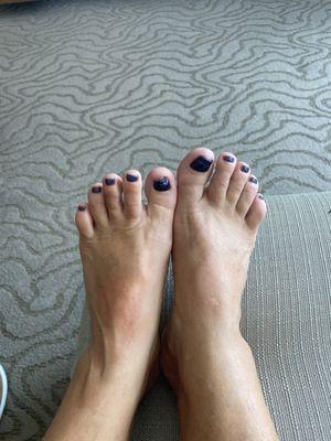 Gel pedicure