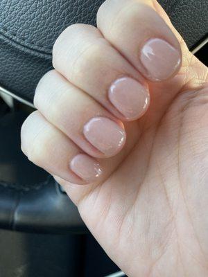 Poorly shaped and thick chunky nails