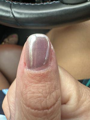 Uneven nails.