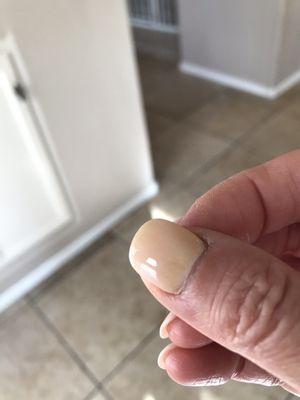 Thumb nail is the most noticeable.