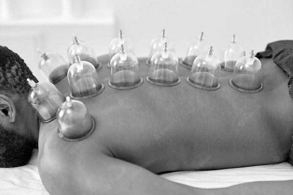 Cupping