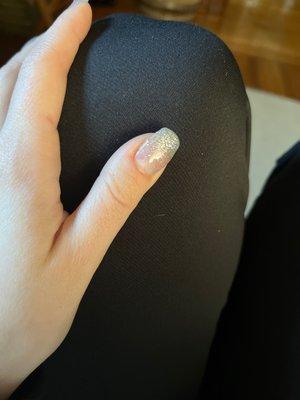 Broken acrylic nail after 6 days