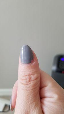 Poorly trimmed cuticles causing gel to lift on thumb by receptionist