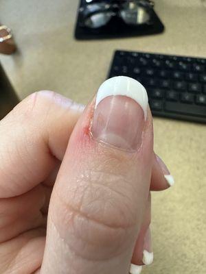 Cut on cuticle area, blood painted over