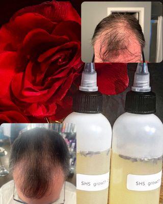 Results from my hair growth oil