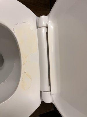 GROSS!  Why hasn't this toilet seat been replaced?