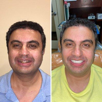 Incredible smile transformation!