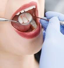 Dental Exam $20 for NEW PATIENTS, ONLY!